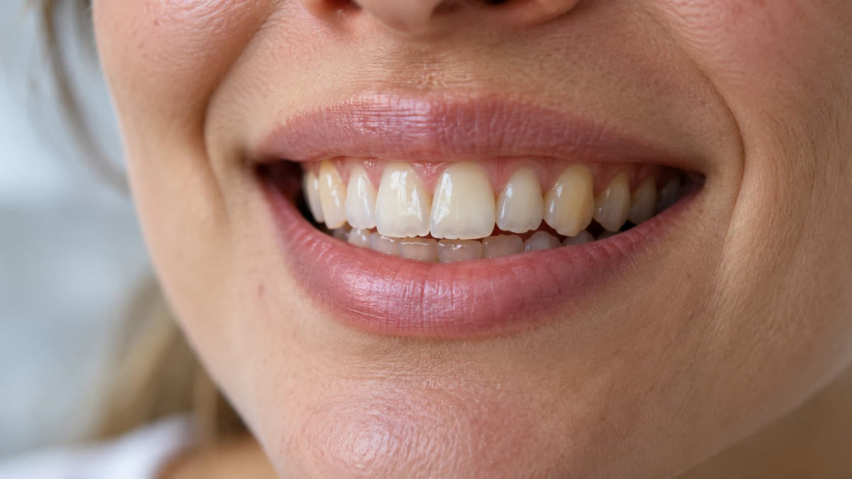 6 Signs Your Enamel Is Thinning